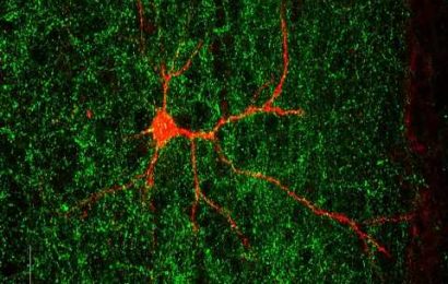 Autism-linked gene found to shape nerve connections