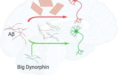 Big dynorphin may protect neurons from the accumulation of Alzheimer’s-associated amyloid