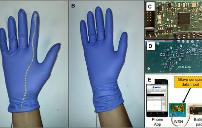 $1 smart glove could help prevent dangerous births by sensing fetal position