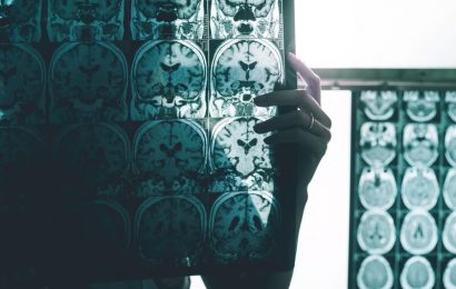 Patients, doctors await FDA decision on experimental Alzheimer’s drug