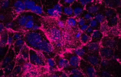 Stress-tolerant cells shown to drive tumor initiation in pancreatic cancer