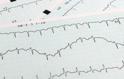 Study opens new avenue to make ECGi a routine clinical application tool for detecting cardiac arrhythmia