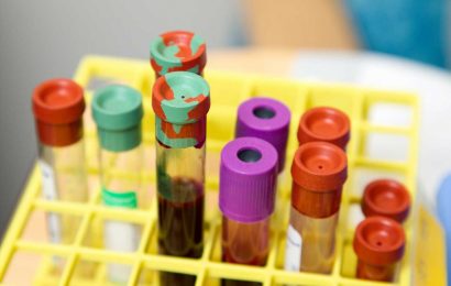 Immune reactions identified that may cause antibody development in hemophilia A cases
