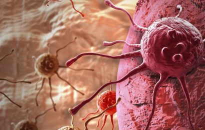 New nanotechnology-based test can detect and profile prostate cancers even in microscopic amounts