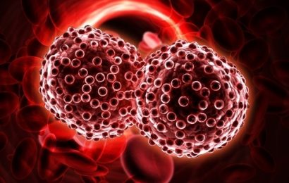 Study provides insight into the immune microenvironment around Hodgkin lymphoma tumors