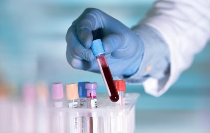 Blood test that detects cancer cells could spare patients chemo