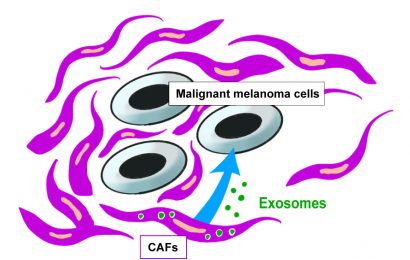 Certain exosomes found to inhibit malignant melanoma growth, providing important prognostic marker