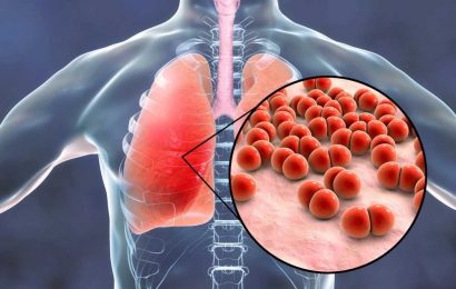 Serious pneumococcal infection increases the risk of a heart attack significantly