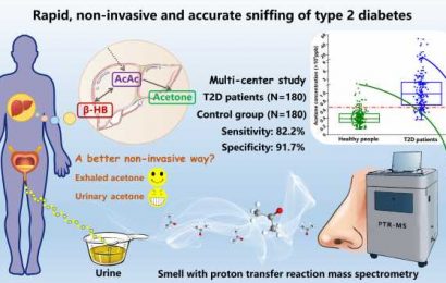Sniffing urinary acetone as a fast way to diagnose type 2 diabetes