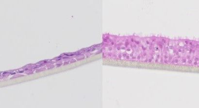 Lung organoids could replace animal testing and boost success in clinical trials