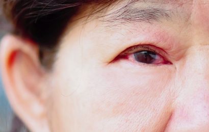 Redness in the eyes could signal glaucoma – risk of vision loss