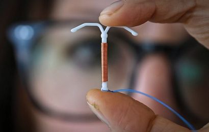 Woman left dizzy after discovering &apos;misplaced&apos; IUD device up her bum