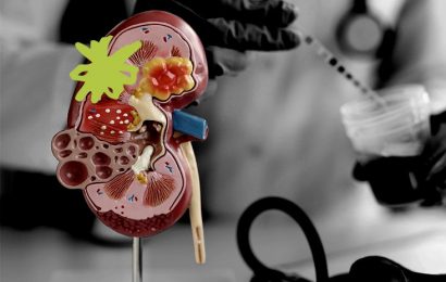 Scientists identify key pathway underlying kidney disease