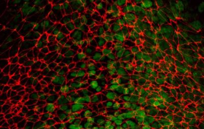 The right moves: How studying cell movement during embryonic development may offer new insights into cancer metastasis