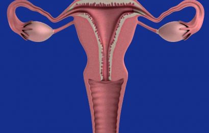 Treatment for uterine fibroids without surgery