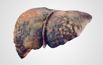 Owlstone Medical presents data demonstrating progress in development of breath biopsy tests for liver cirrhosis and NASH