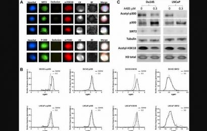 A multiplex assay to assess activated p300/CBP in circulating prostate tumor cells