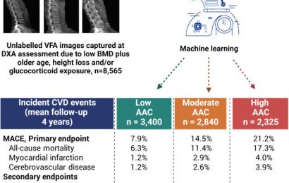 AI to predict your health later in life: Researchers develop software to analyze bone density scans