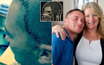 Man who became &apos;horny and aggressive&apos; diagnosed with a brain tumour