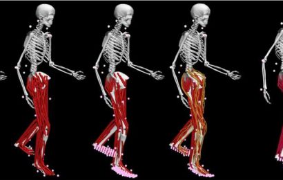 New open-source software designs optimized, personalized treatments for movement impairments