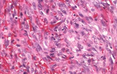 Scientists uncover the Rosetta stone of sarcoma research to personalize treatment