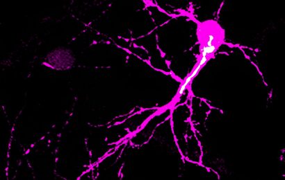 Uncovering how the Golgi apparatus impacts early postnatal neuron development