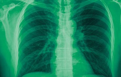 Classification of COPD Exacerbation Predicts Prognosis
