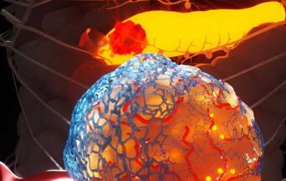 Drug that targets scar-like tissue in tumors shows promise for aggressive pancreatic cancer