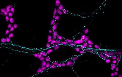 How sensory neurons impact the gut