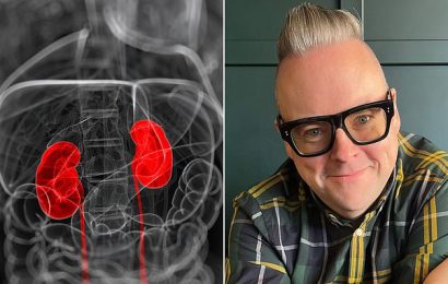 &apos;Millions should be offered a test to spot signs of kidney disease&apos;