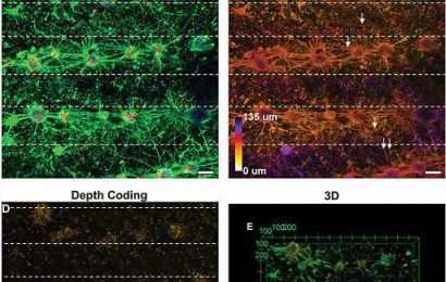 Bioprinting living brain cell networks in the lab