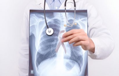 Incidence of lung cancer higher in women versus men aged 35 to 54 years, says research