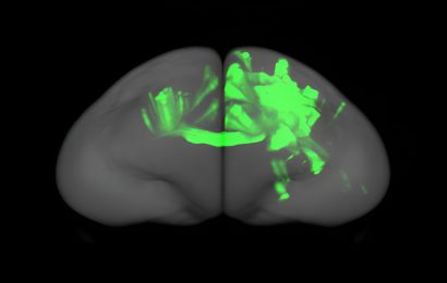 Marmoset study finds prefrontal cortex has two distinct types of connections to other cortical areas
