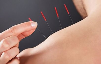 Acupuncture aids outcomes after heart valve surgery
