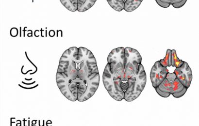 Novel MRI reveals brain changes in long COVID patients