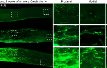 Researchers find that youthful proteins help nerves regrow