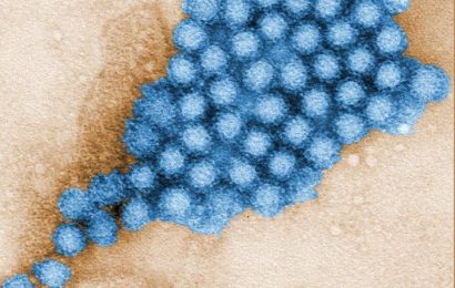 What to know about norovirus