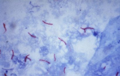Drug-resistant tuberculosis may be under-diagnosed, says genomic analysis in southern Mozambique